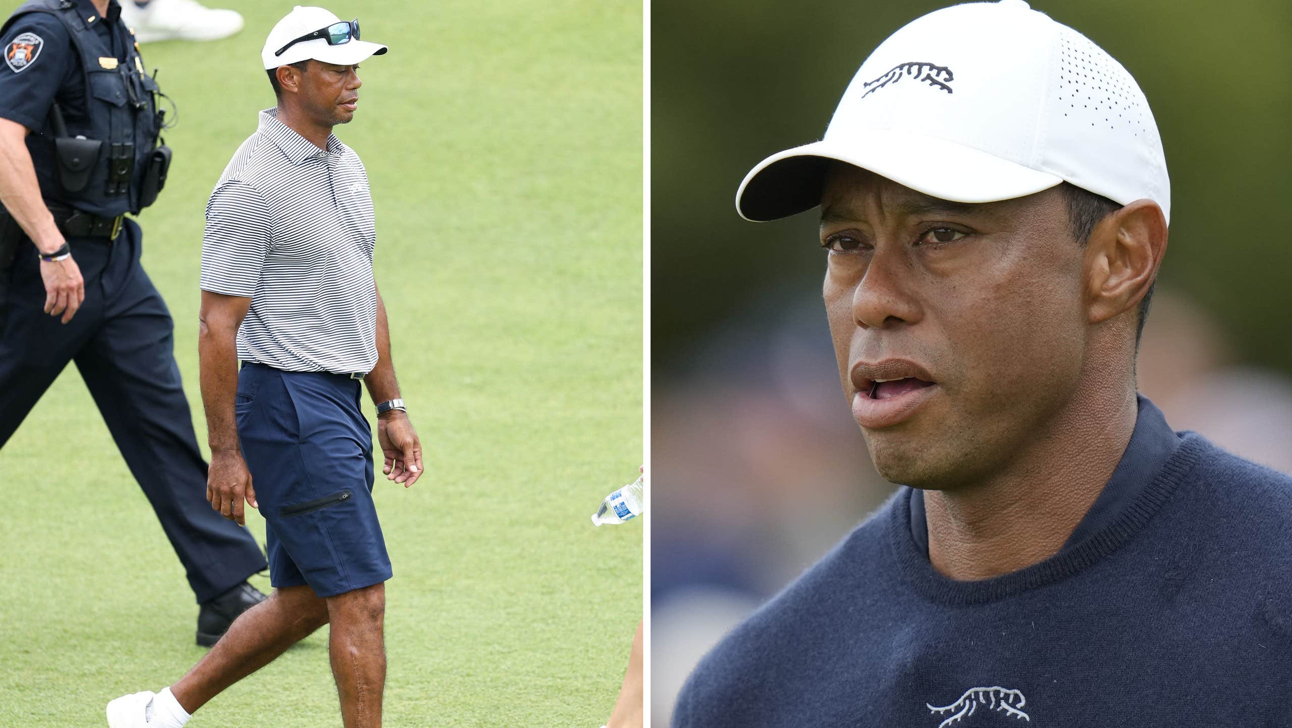 Tiger Woods visar upp skadorna efter bilolyckan | Golf