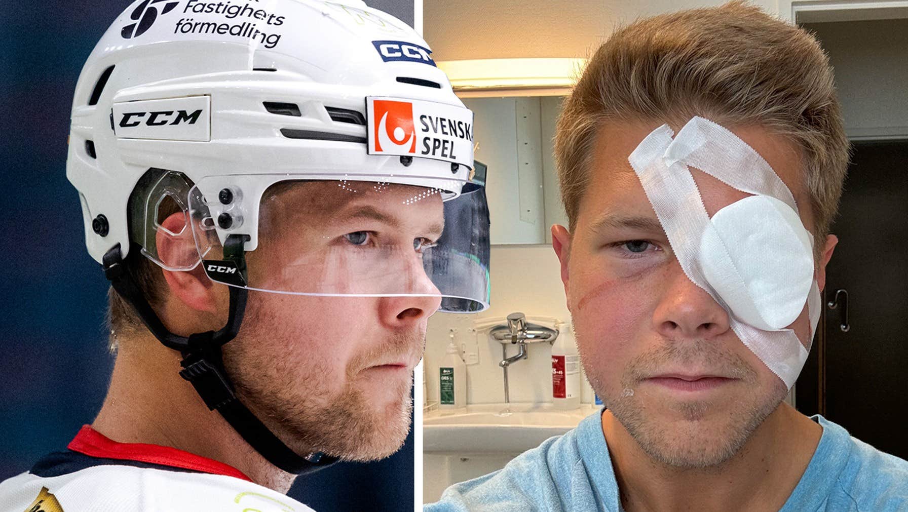 Victor Öhman akut opererad – kunde blivit blind | Hockey