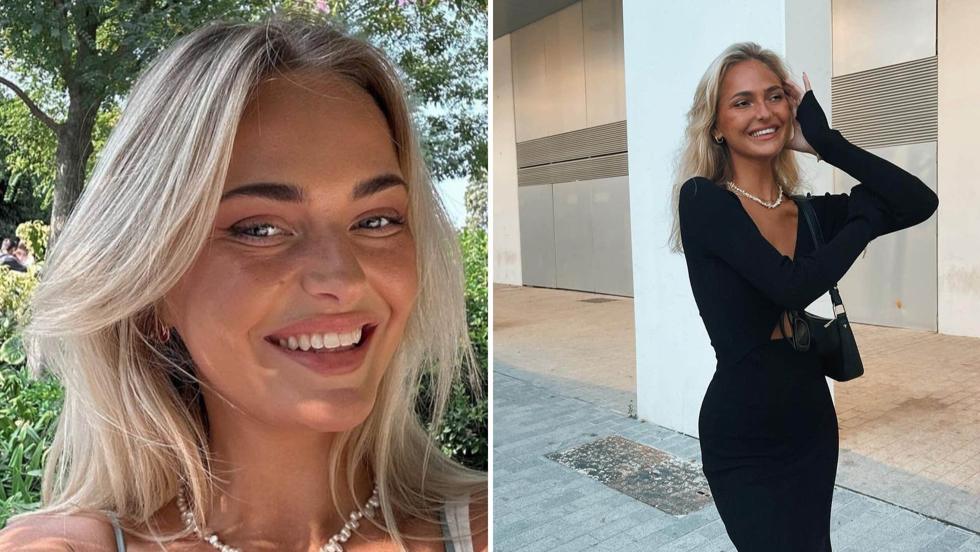 Fanny, 26, är ”blind i huvudet” – förklarar ovanliga tillståndet